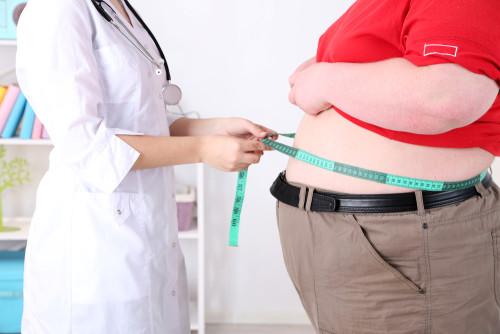 как лечить ожирение